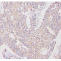 Aspartate Aminotransferase Rabbit mAb 
