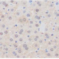 Aspartate Aminotransferase Rabbit mAb 