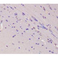 BMP6 Rabbit mAb