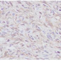 BMP6 Rabbit mAb