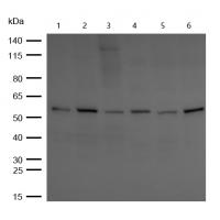 CBX2 Rabbit mAb
