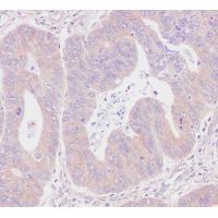 CLPTM1 Rabbit mAb