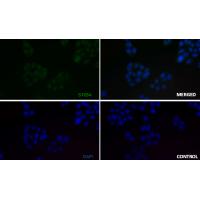 CCDC98 Rabbit mAb