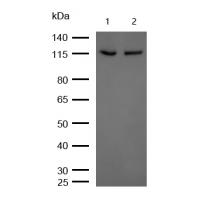 TAOK1 Rabbit mAb