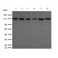 TAOK1 Rabbit mAb