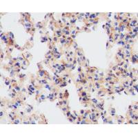Phospho-MCU(S92) Antibody