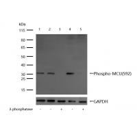 Phospho-MCU(S92) Antibody