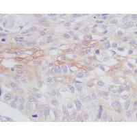 Phospho-MCU(S92) Antibody
