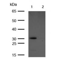 active + pro Caspase 3  Rabbit mAb 
