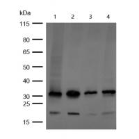 active + pro Caspase 3  Rabbit mAb 