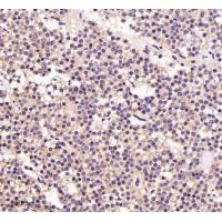 active + pro Caspase 3  Rabbit mAb 