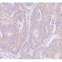 NG2 Rabbit mAb