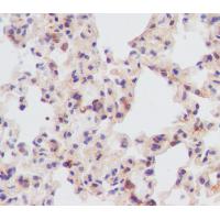 Yes1 Rabbit mAb
