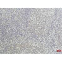 TNF-α Mouse mAb