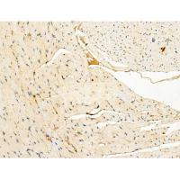 BCKDHA (Phospho Ser292/Ser337) Antibody