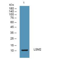 LSM2 Rabbit pAb