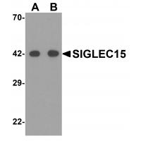 SIGLEC15 Antibody