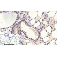 P38 MAPK(Phospho-Thr180/Tyr182) antibody