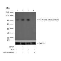 PI3-kinase p85- alpha (Phospho-Tyr607) Rabbit mAb