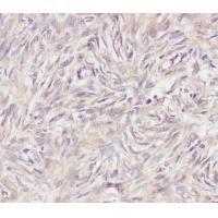 PI3-kinase p85- alpha (Phospho-Tyr607) Rabbit mAb