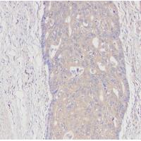 PI3-kinase p85- alpha (Phospho-Tyr607) Rabbit mAb