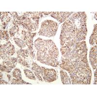 PPARA Rabbit mAb