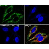 HADHSC Antibody
