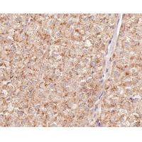 PI3-kinase p85 subunit alpha Antibody
