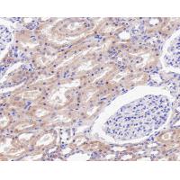 PI3-kinase p85 subunit alpha Antibody