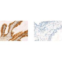 CMAS antibody
