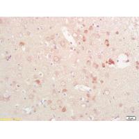 EPHB1 (Phospho-Tyr928) Antibody
