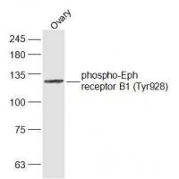EPHB1 (Phospho-Tyr928) Antibody