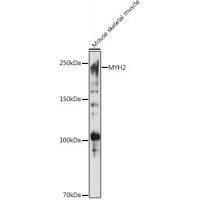 MYH2 Rabbit Polyclonal Antibody