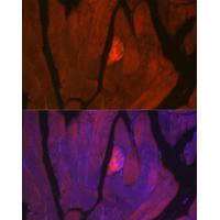 MYH2 Rabbit Polyclonal Antibody