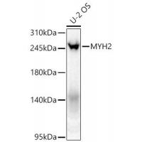 MYH2 Rabbit Polyclonal Antibody