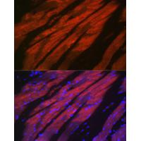 MYH2 Rabbit Polyclonal Antibody