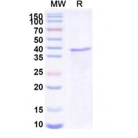 Recombinant Human WNT3A Protein, N-His