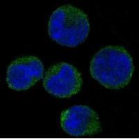 CDK6 Rabbit mAb