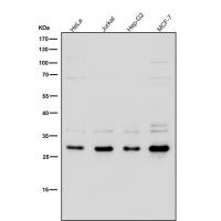 SLC31A1 Rabbit mAb