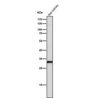 SLC31A1 Rabbit mAb