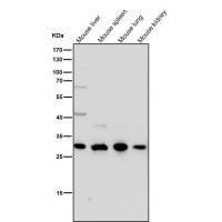 SLC31A1 Rabbit mAb