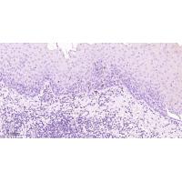 CD1A Rabbit mAb