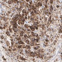 CD63 Rabbit mAb