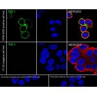 TIM 3 Rabbit mAb