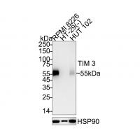 TIM 3 Rabbit mAb