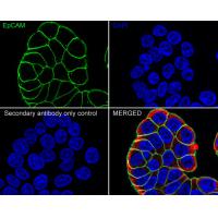 EpCAM Rabbit mAb