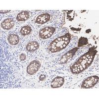 EpCAM Rabbit mAb