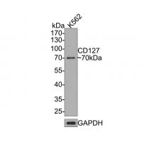 CD127 Rabbit mAb