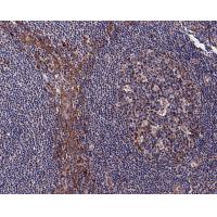 CD127 Rabbit mAb