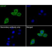 CD127 Rabbit mAb